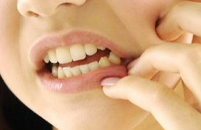 突發(fā)性、自發(fā)性的劇烈牙疼