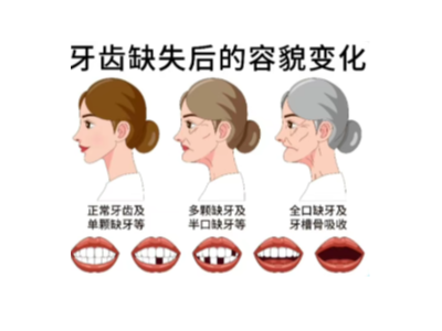 【科學(xué)科普】十個(gè)常用的口腔小知識(shí)！
