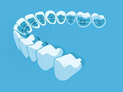 惟德口腔醫(yī)院口腔正畸好不好？