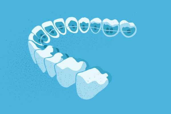 惟德口腔醫(yī)院口腔正畸好不好？